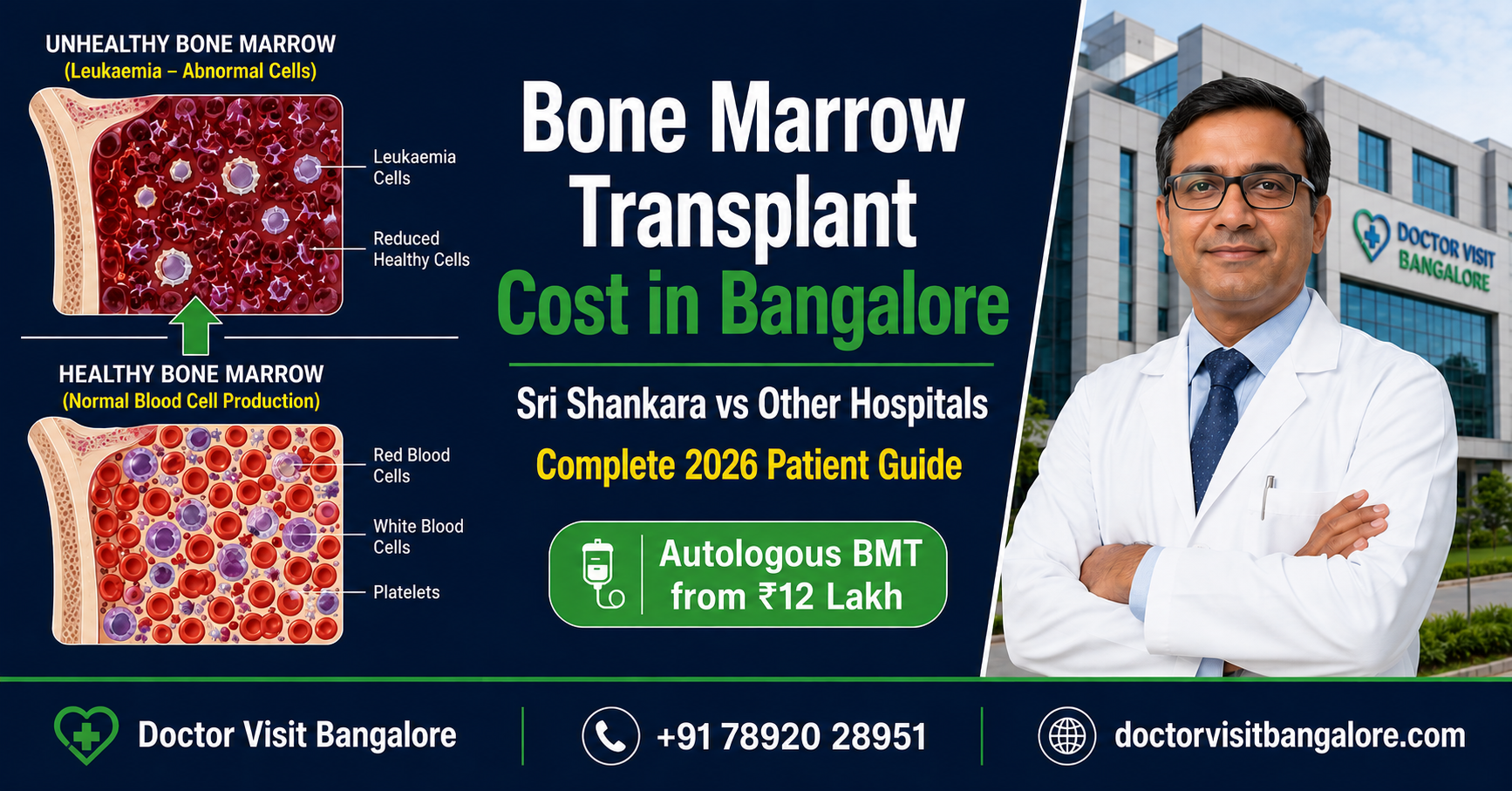 Bone Marrow Transplant Cost in Bangalore — Sri Shankara vs Other Hospitals 2026 Guide by Doctor Visit Bangalore